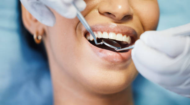 Best Urgent Care for Lost Fillings or Crowns in Gibbsboro, NJ